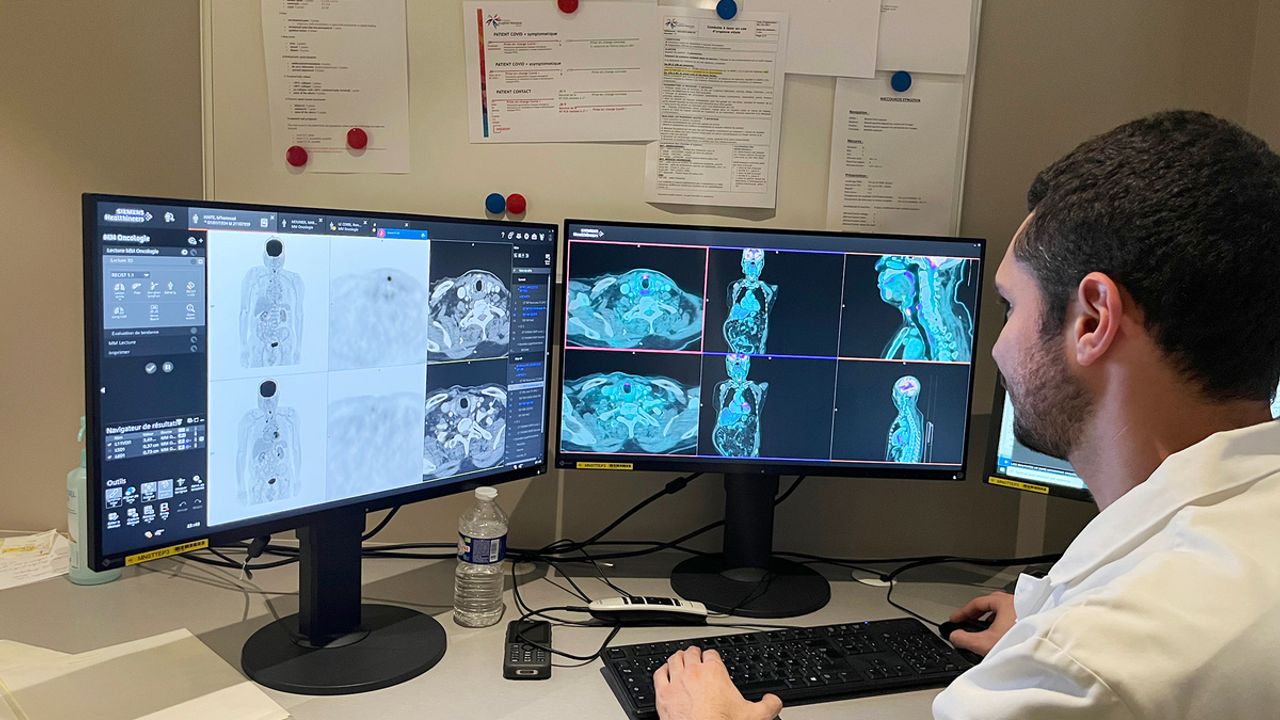 une personne devant des ordinateurs qui montrent des imageries médicales