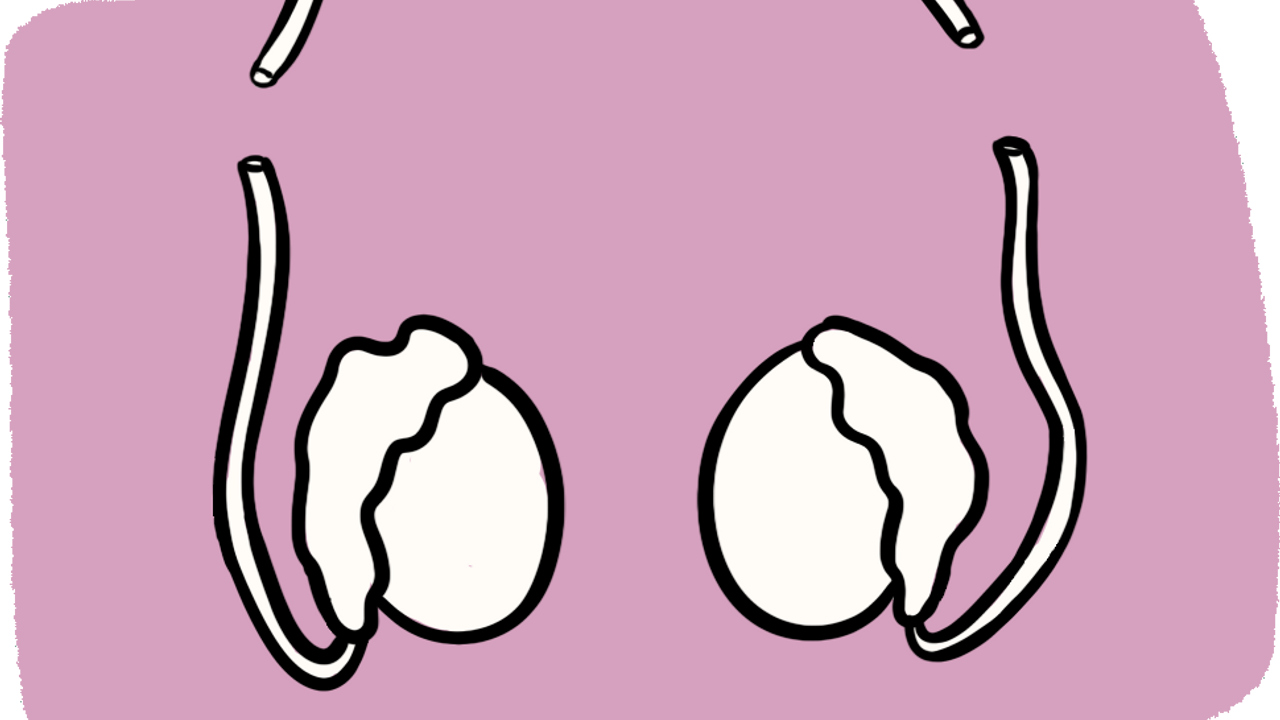 Illustration d'une vasectomie pour la contraception masculine